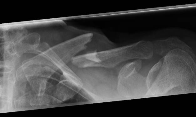 Positive Strahlenwirkungen – Teil 2: Wie ist das alles zu verstehen?